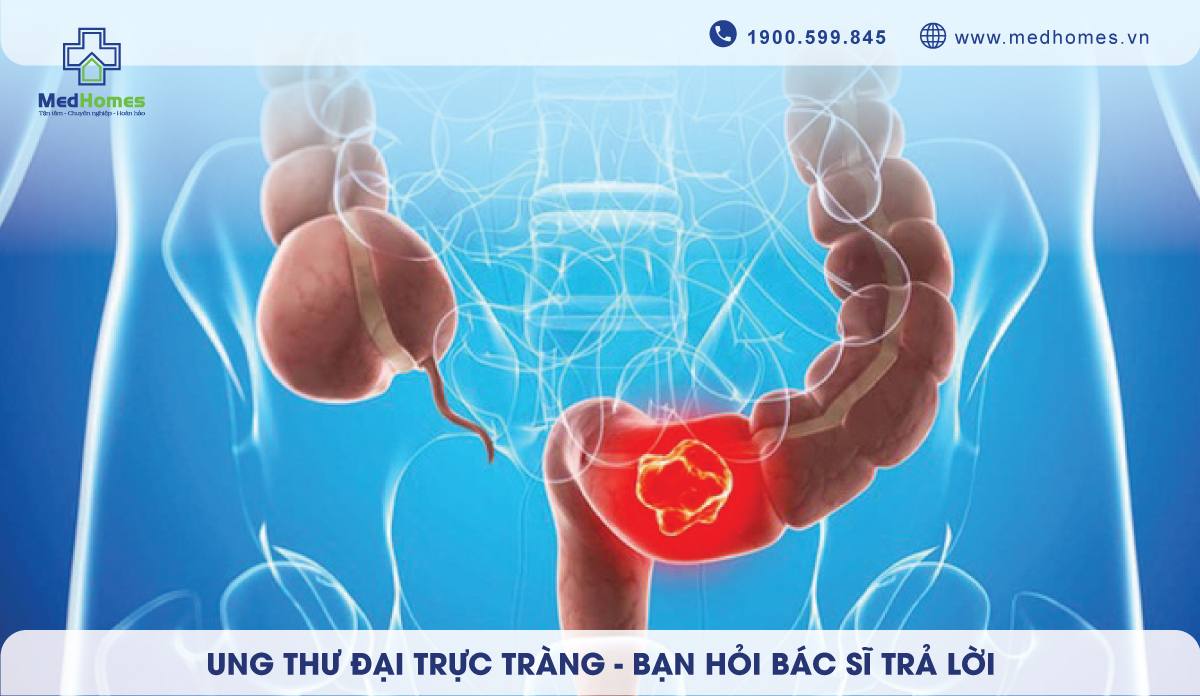 Làm sao để nhận biết dấu hiệu ung thư trực tràng và điều trị kịp thời?