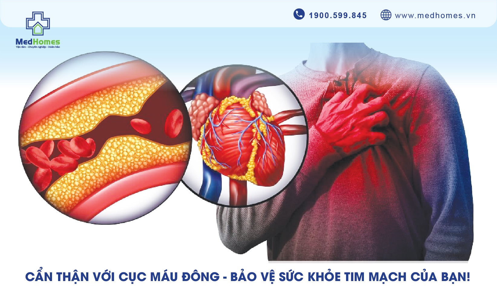 Cẩn Thận Với Cục Máu Đông - Bảo Vệ Sức Khỏe Tim Mạch Của Bạn!