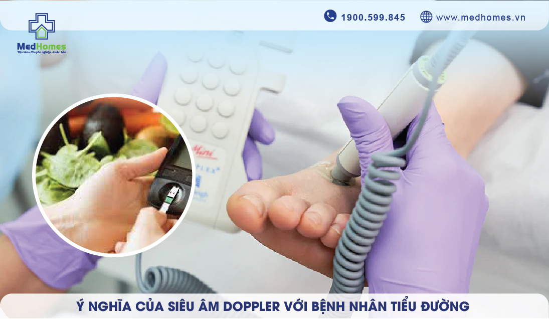 Vai trò của Siêu âm Doppler trong phát hiện bệnh lý mạch máu với bệnh nhân tiểu đường