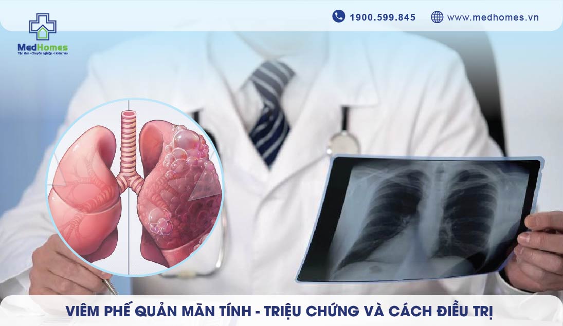 Viêm phế quản mãn tính - Triệu chứng và cách điều trị