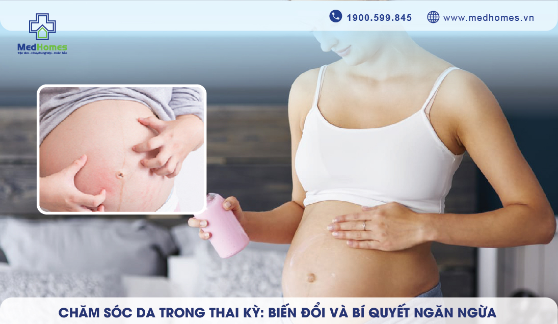 Chăm Sóc Da Trong Thai Kỳ: Biến Đổi và Bí Quyết Ngăn Ngừa