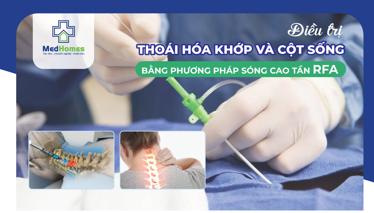 Điều Trị Thoái Hóa Khớp Và Cột Sống – Giải Pháp Hiệu Quả Với Sóng Cao Tần RFA Tại Phòng Khám MedHomes