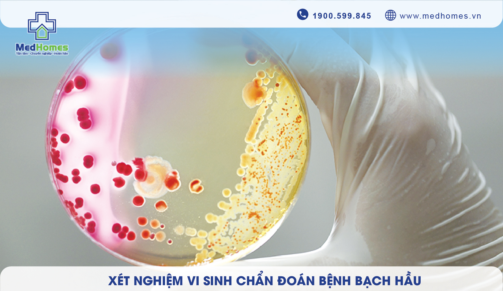 Xét Nghiệm Vi Sinh Chẩn Đoán Bệnh Bạch Hầu