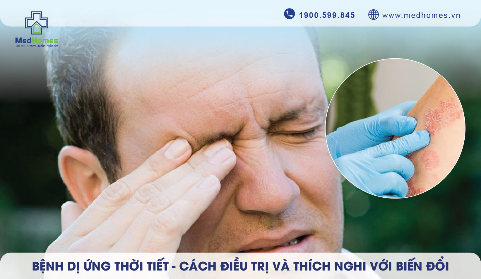 Bệnh dị ứng thời tiết - Cách điều trị và thích nghi với biến đổi thời tiết