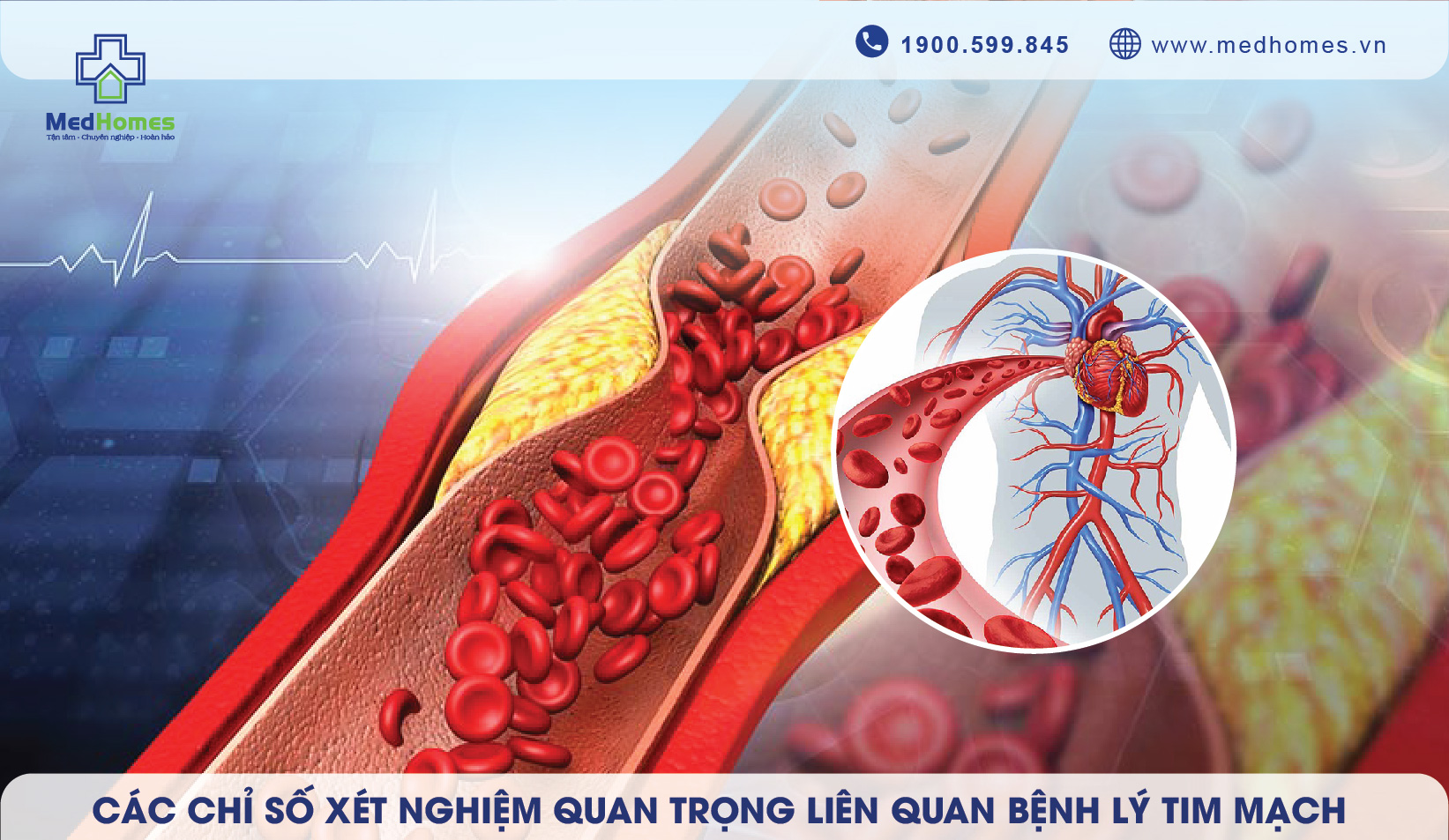 Các chỉ số xét nghiệm quan trọng giúp bạn phát hiện sớm và phòng ngừa các bệnh lý tim mạch