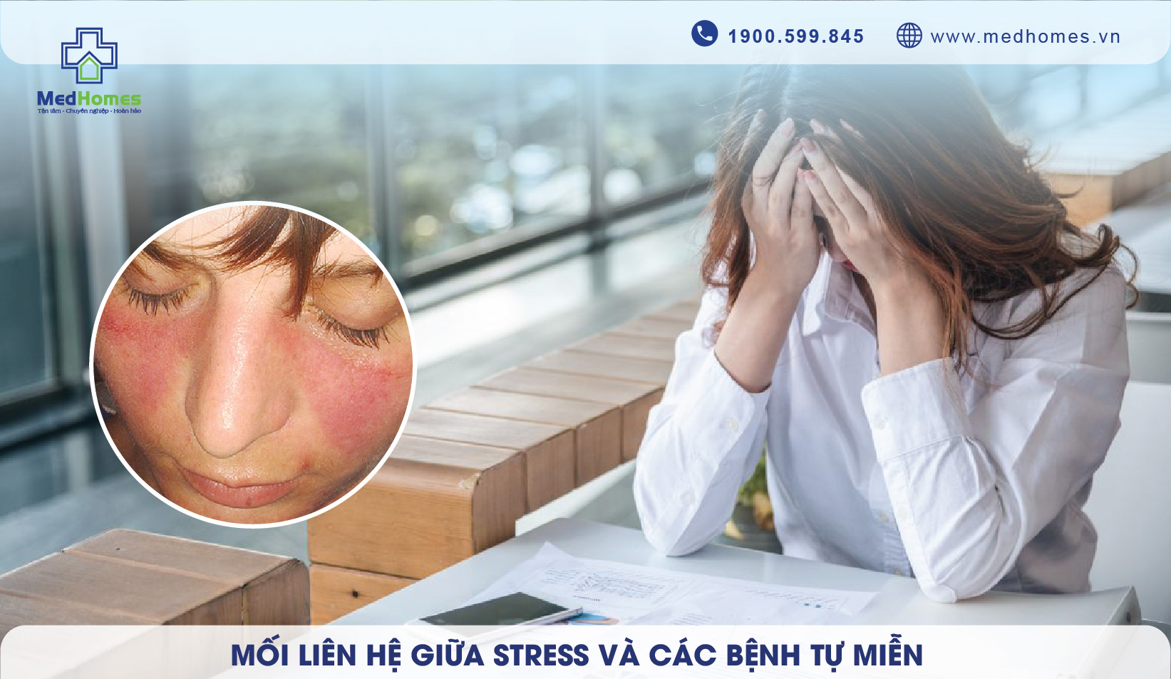 Mối Liên Hệ Giữa Stress Và Các Bệnh Tự Miễn
