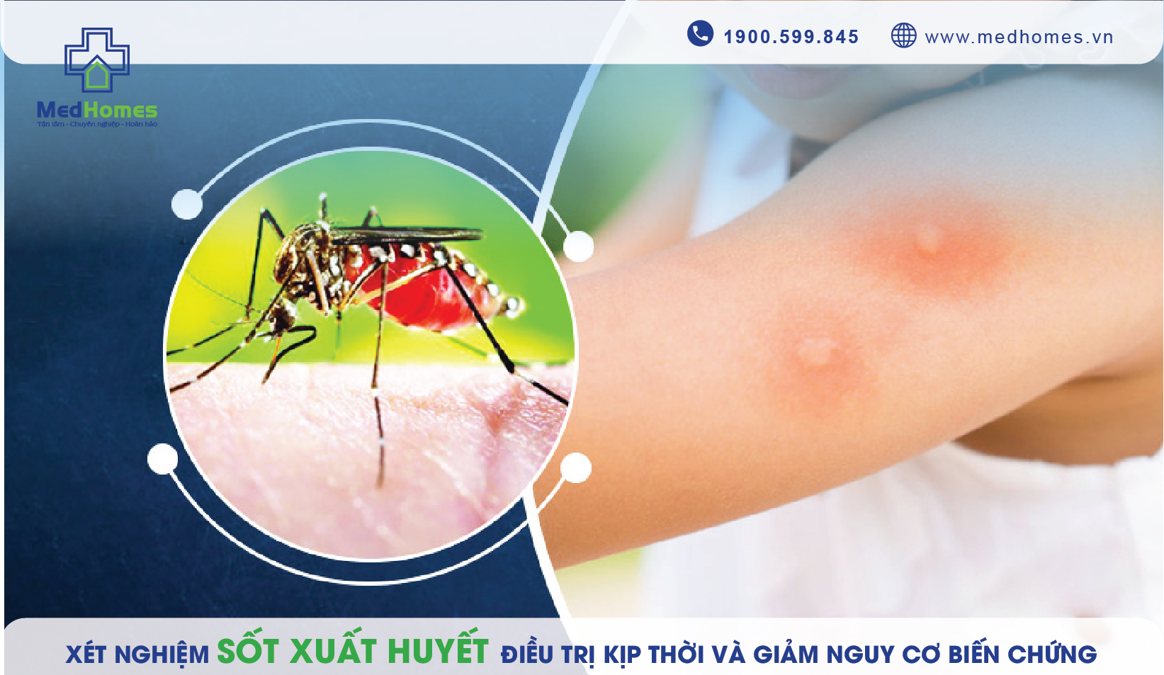 Dịch vụ Xét Nghiệm nhanh Sốt xuất huyết 