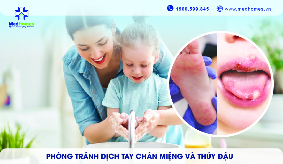 Phòng tránh sự lây lan dịch tay chân miệng và thủy đậu
