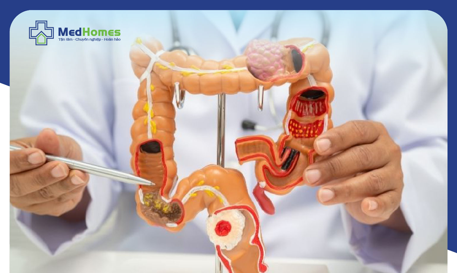  NỘI SOI CẮT POLYP VÀ LẤY DỊ VẬT: ÍT XÂM LẤN, NHANH HỒI PHỤC