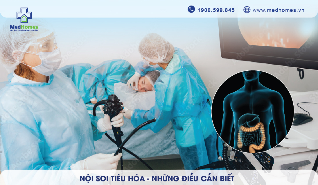 Những điều cần biết về nội soi tiêu hóa