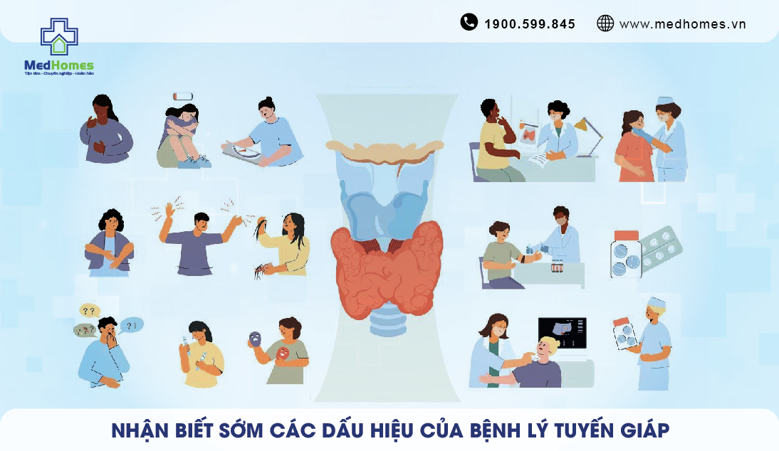 DẤU HIỆU CỦA BỆNH LÝ TUYẾN GIÁP 