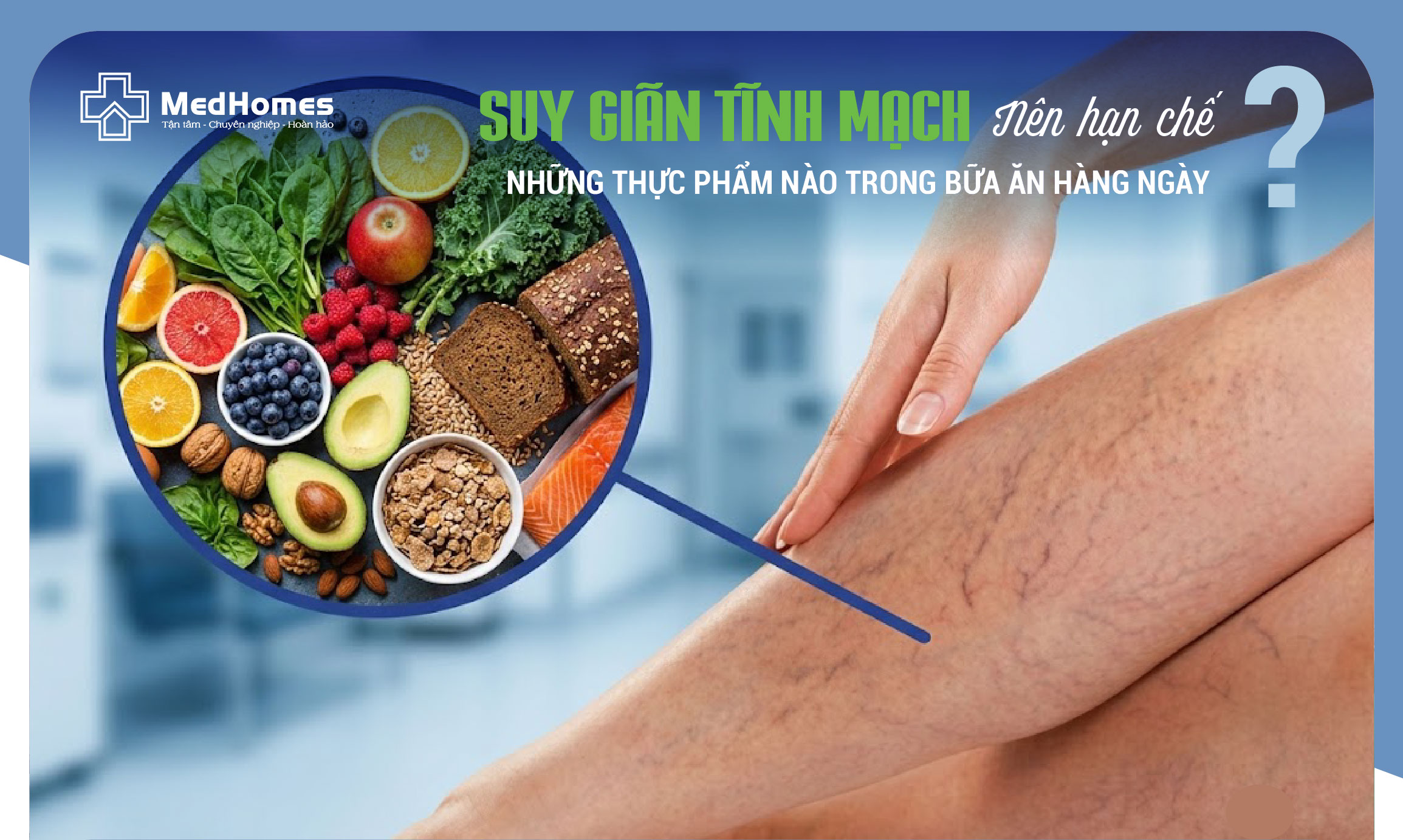  SUY GIÃN TĨNH MẠCH: NÊN HẠN CHẾ NHỮNG THỰC PHẨM NÀO TRONG BỮA ĂN HÀNG NGÀY?
