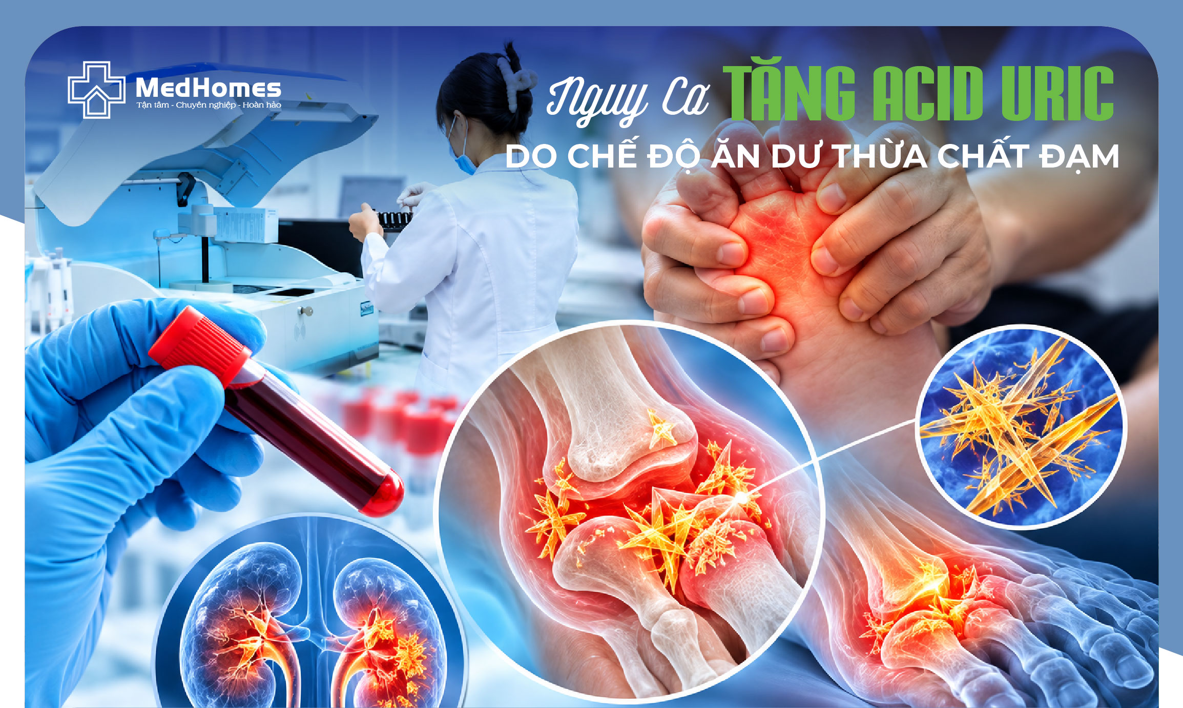  NGUY CƠ TĂNG ACID URIC DO CHẾ ĐỘ ĂN DƯ THỪA CHẤT ĐẠM! 