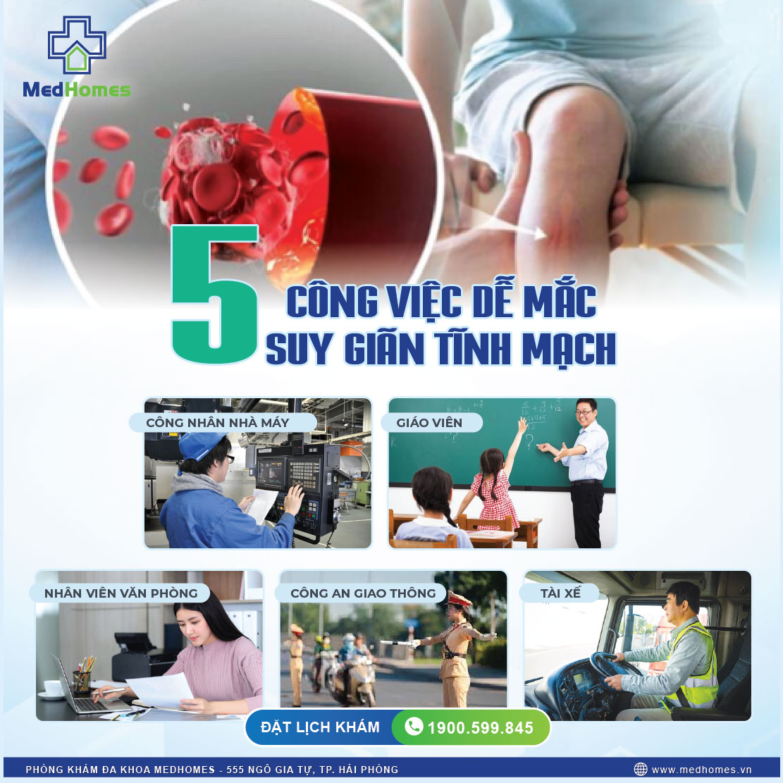 5 CÔNG VIỆC DỄ MẮC SUY GIÃN TĨNH MẠCH – BẠN CÓ TRONG DANH SÁCH KHÔNG?