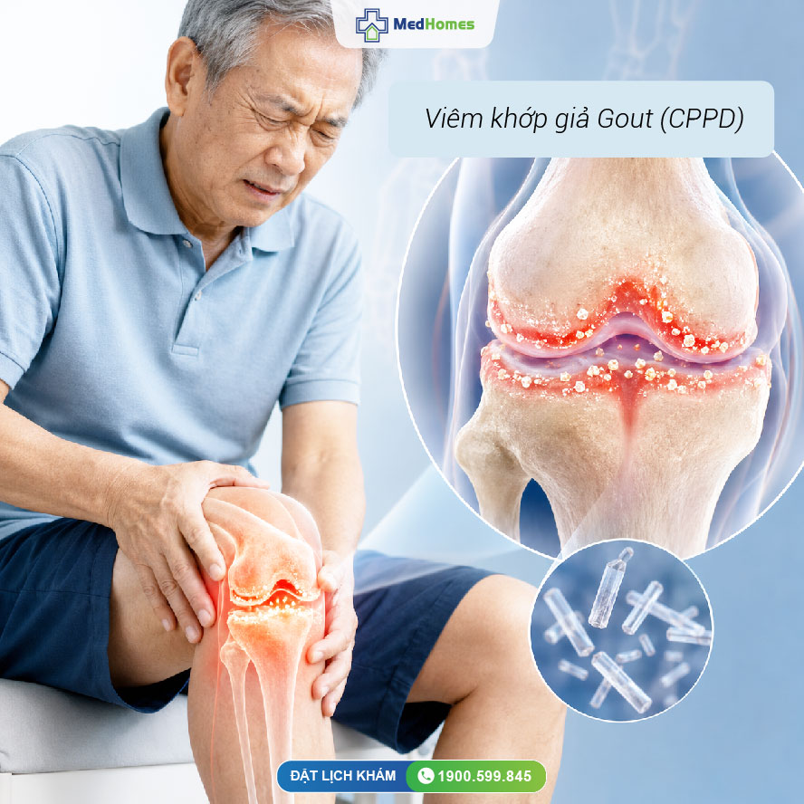  TIÊM NỘI KHỚP: GIẢI PHÁP ĐIỀU TRỊ DẬP TẮT CƠN ĐAU VIÊM CẤP!