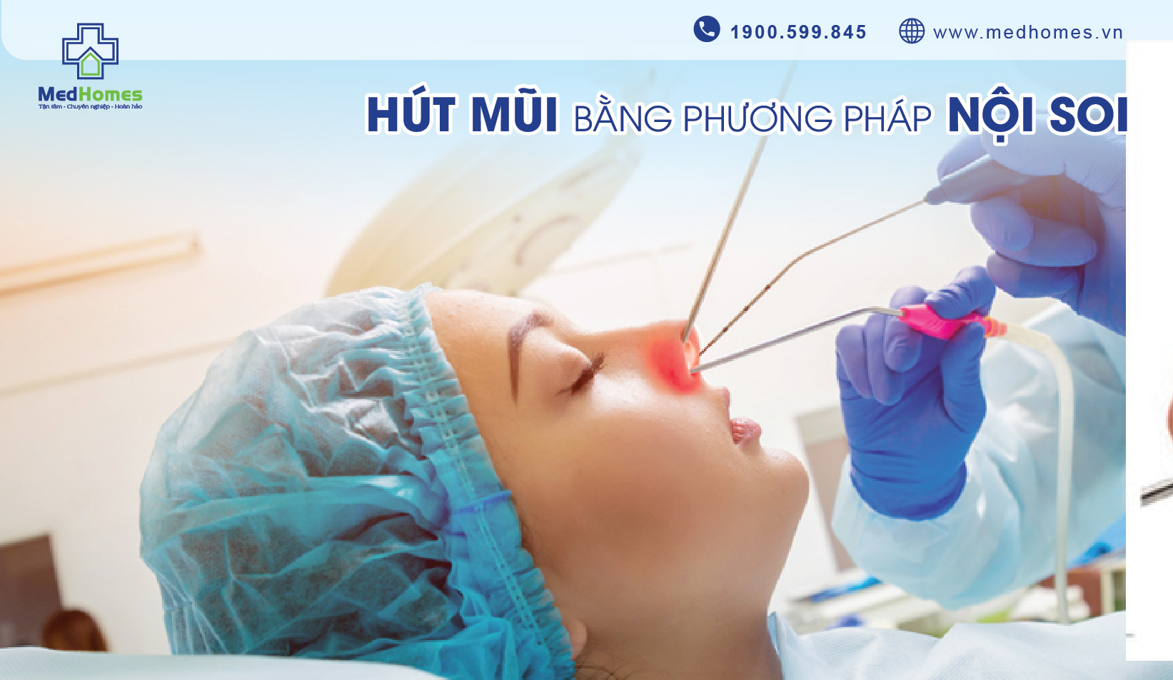 Hút Mũi Bằng Phương Pháp Nội Soi