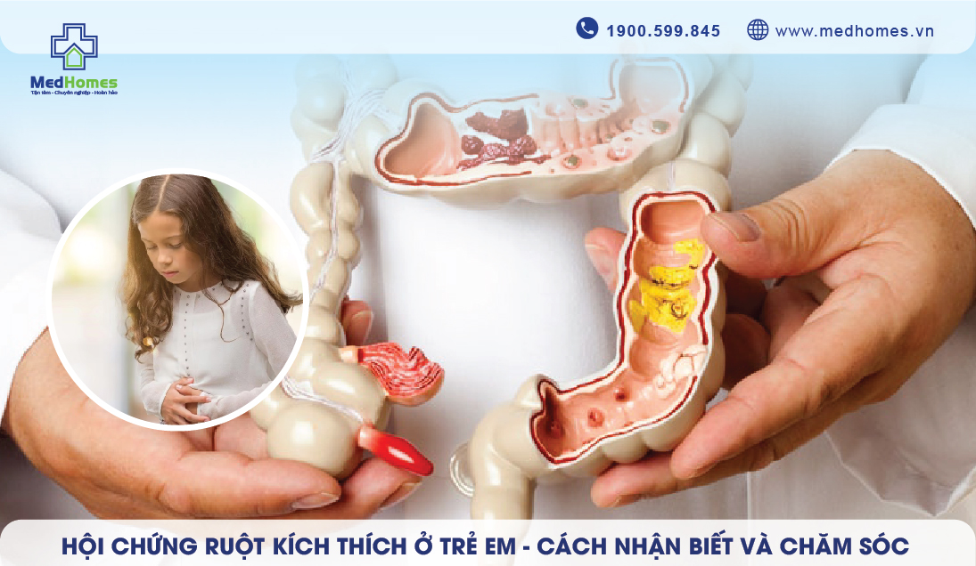 Hội Chứng Ruột Kích Thích ở Trẻ Em - Cách nhận biết và chăm sóc