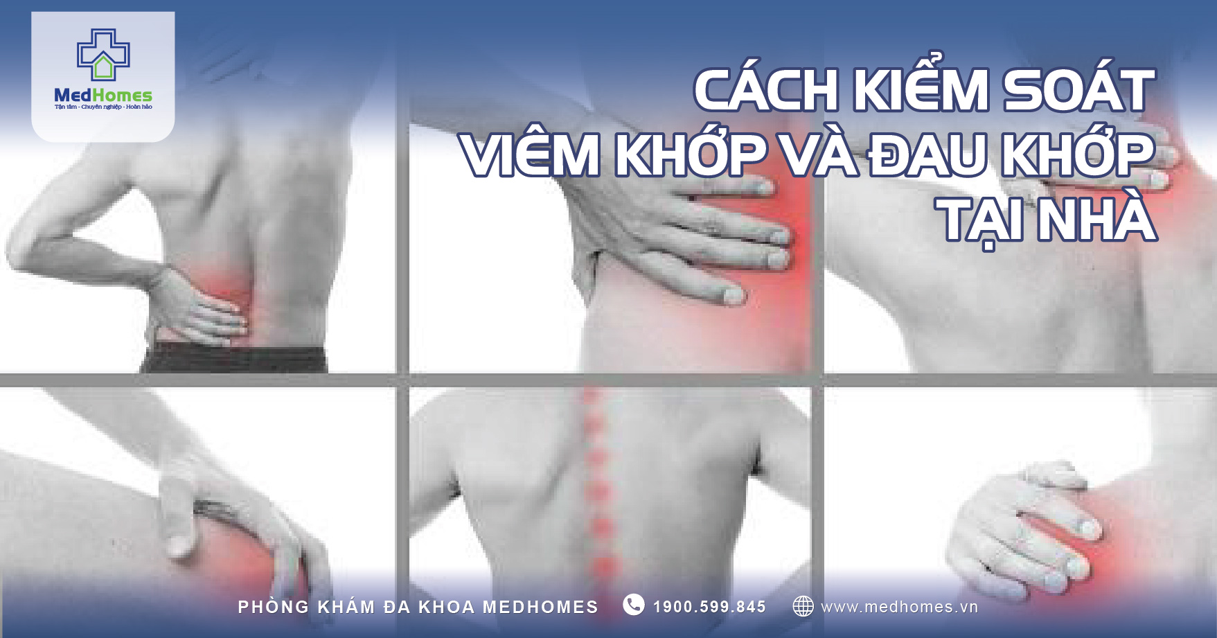 CÁCH KIỂM SOÁT VIÊM KHỚP VÀ ĐAU KHỚP TẠI NHÀ: MẸO HIỆU QUẢ 