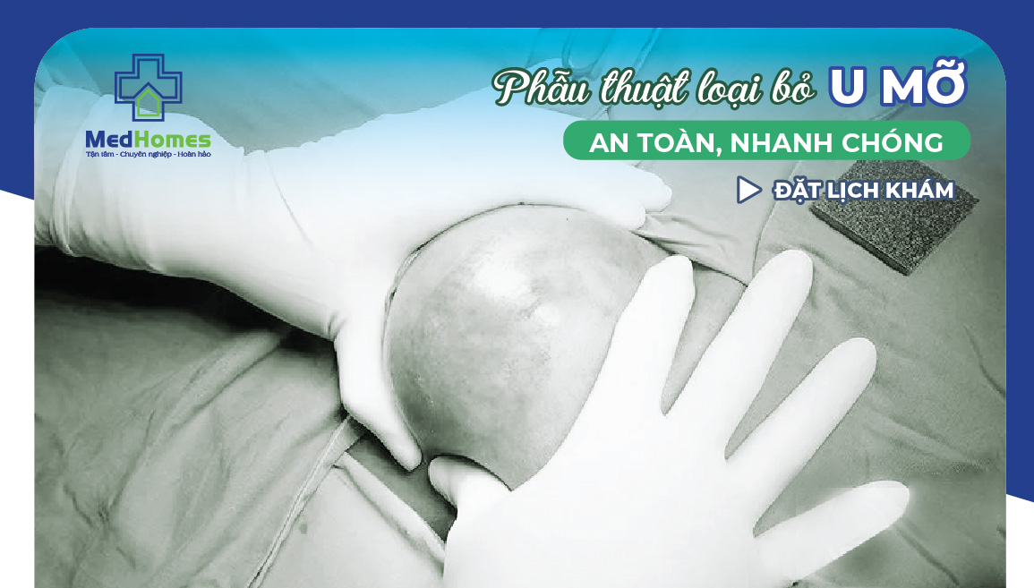 PHẪU THUẬT LOẠI BỎ U MỠ tại MedHomes