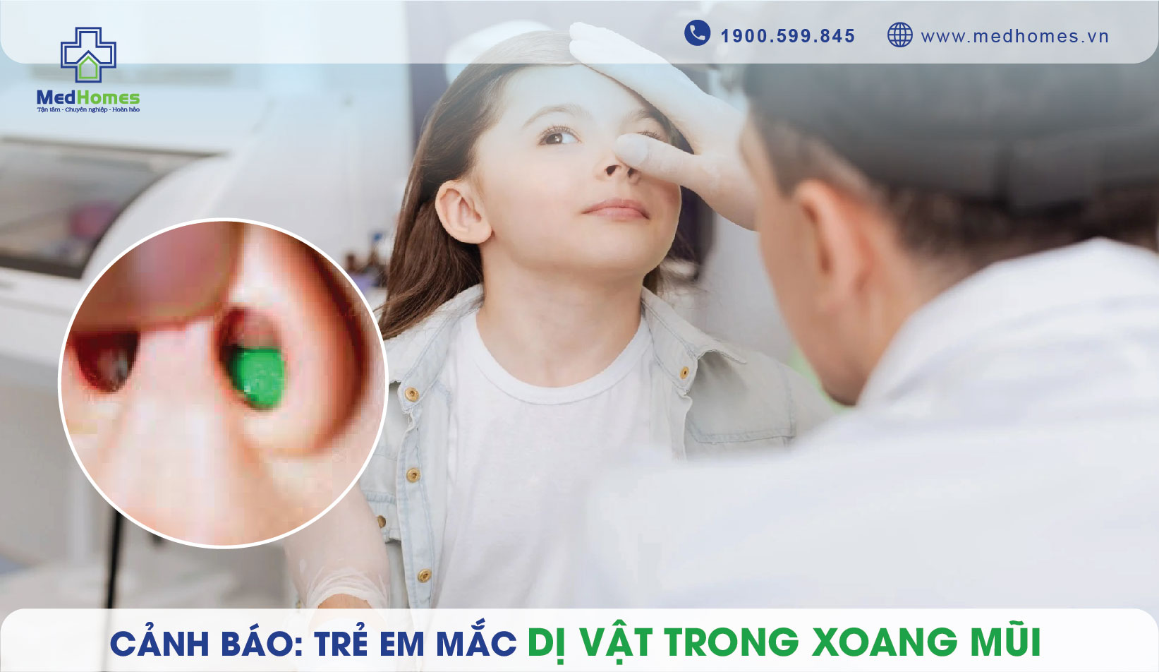 Cảnh Báo: Trẻ Em Mắc Dị Vật Trong Xoang Mũi