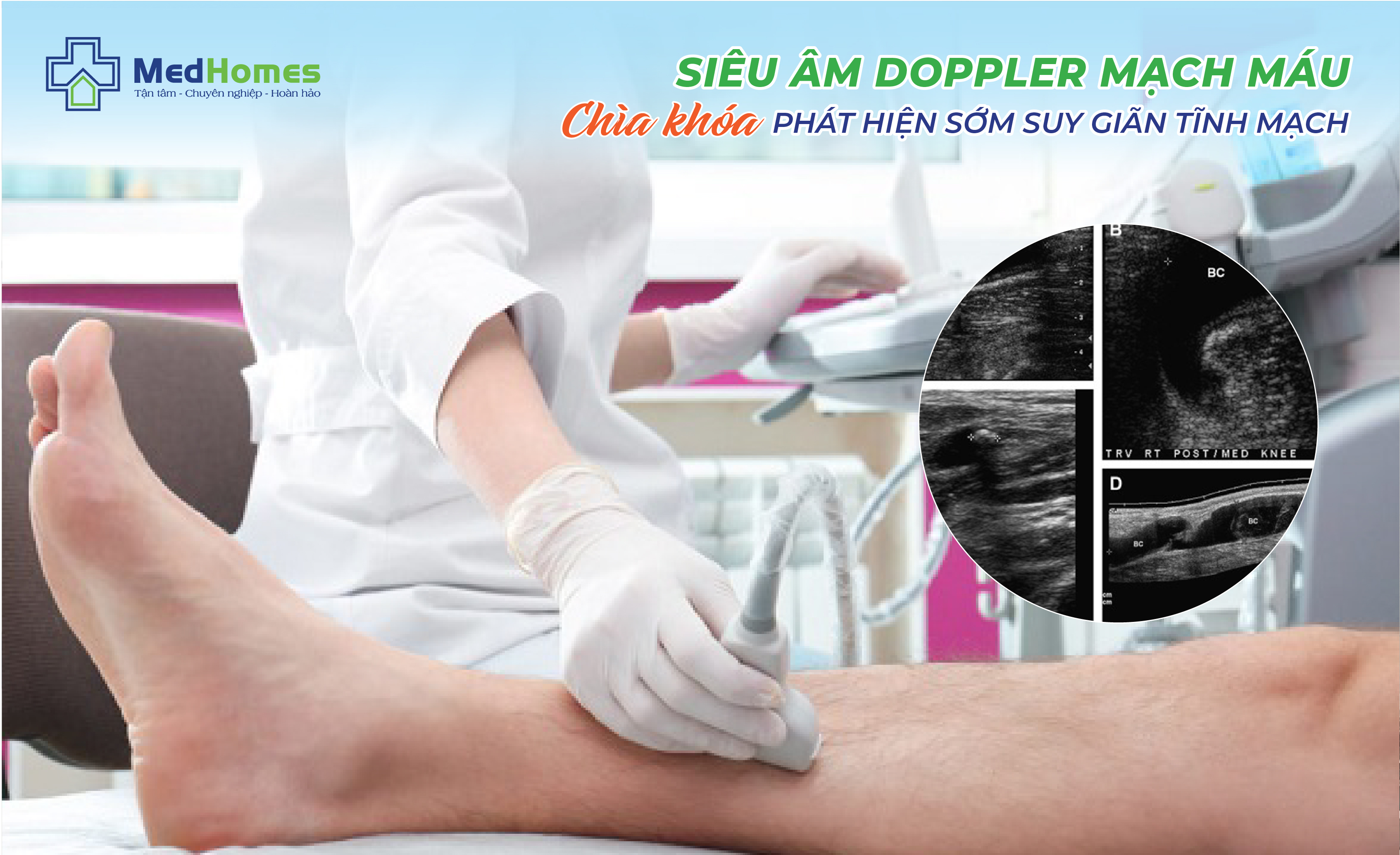 SIÊU ÂM DOPPLER MẠCH MÁU – “CHÌA KHÓA” PHÁT HIỆN SỚM SUY GIÃN TĨNH MẠCH