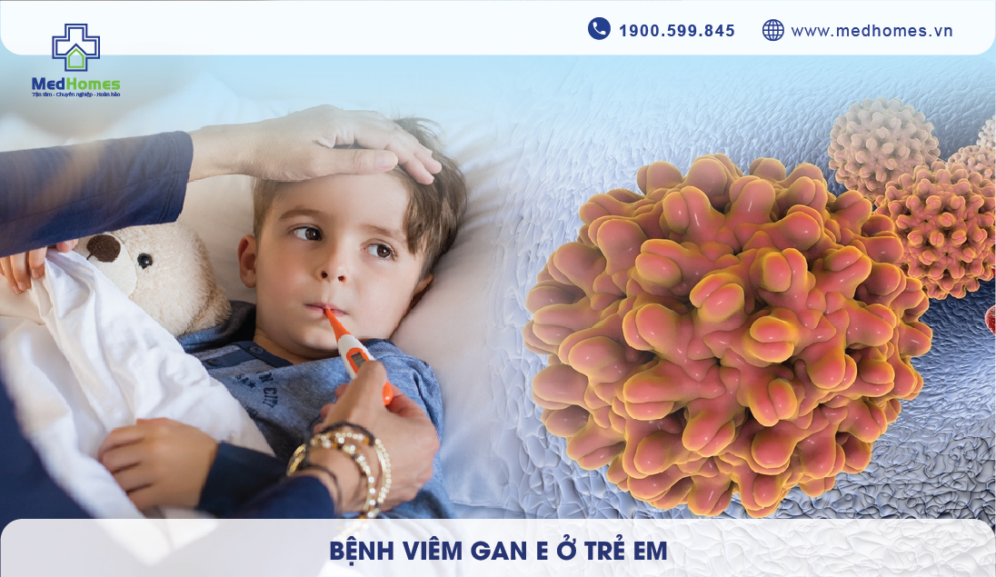 Bệnh viêm gan E ở trẻ em: Nguyên nhân, triệu chứng và cách điều trị