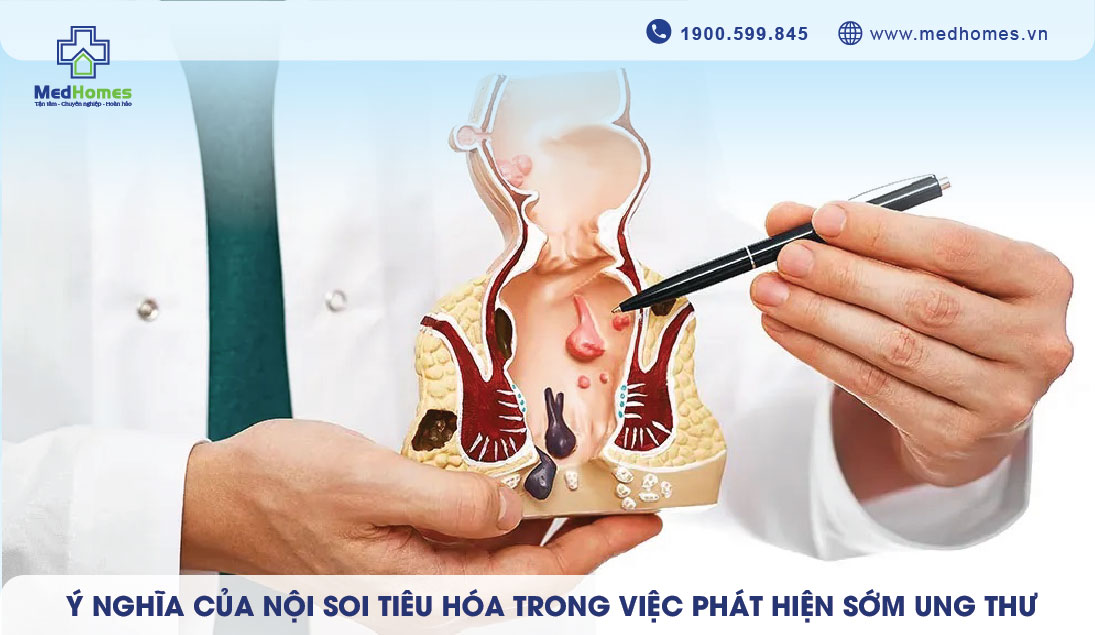 Ý NGHĨA CỦA NỘI SOI TIÊU HÓA TRONG VIỆC PHÁT HIỆN SỚM UNG THƯ